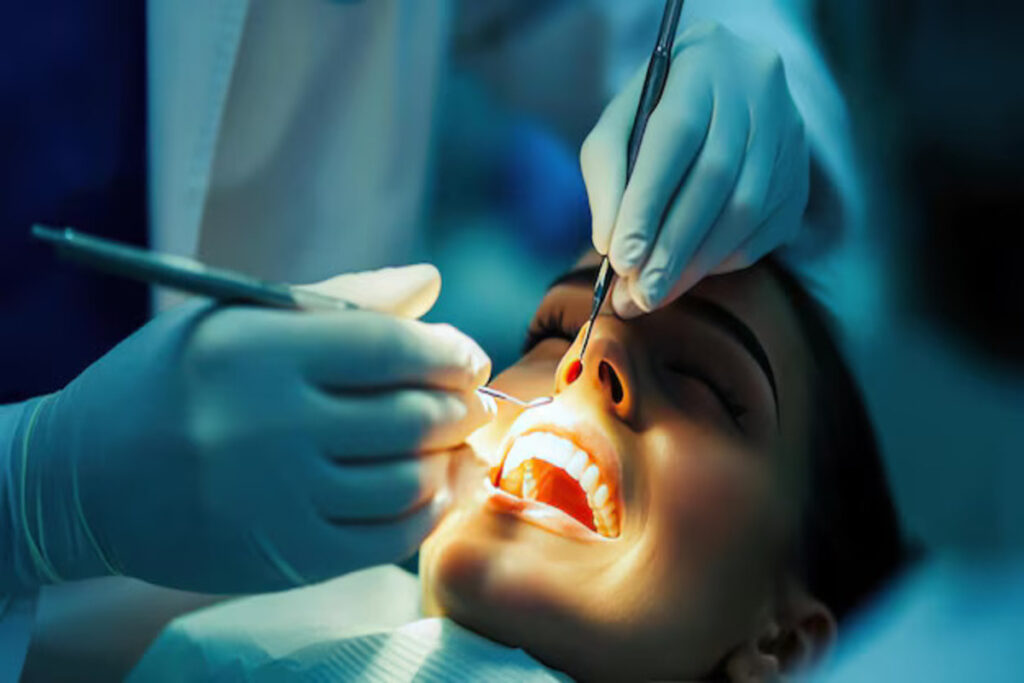 Dental Filling Treatment in India