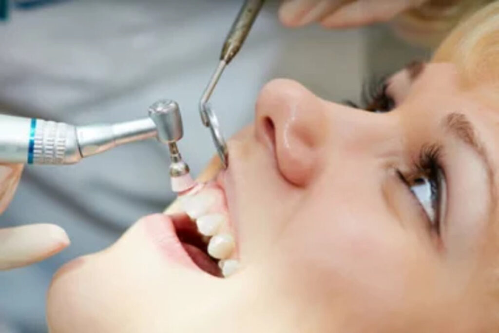 Best Dental Treatment in India